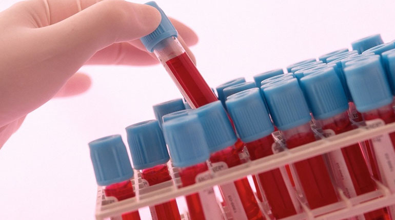 oznaczenia stężenia kortyzolu