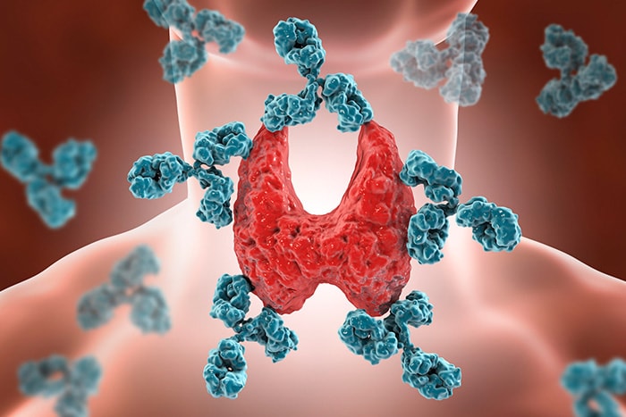 Choroba Hashimoto just be fit